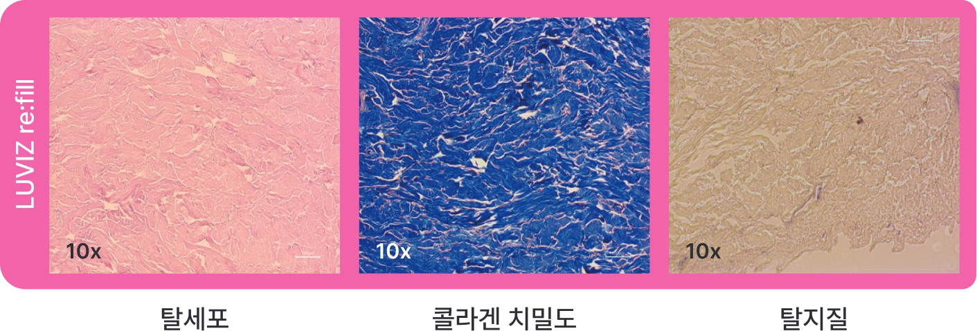 가공 후 (LUVIZ re:fill)