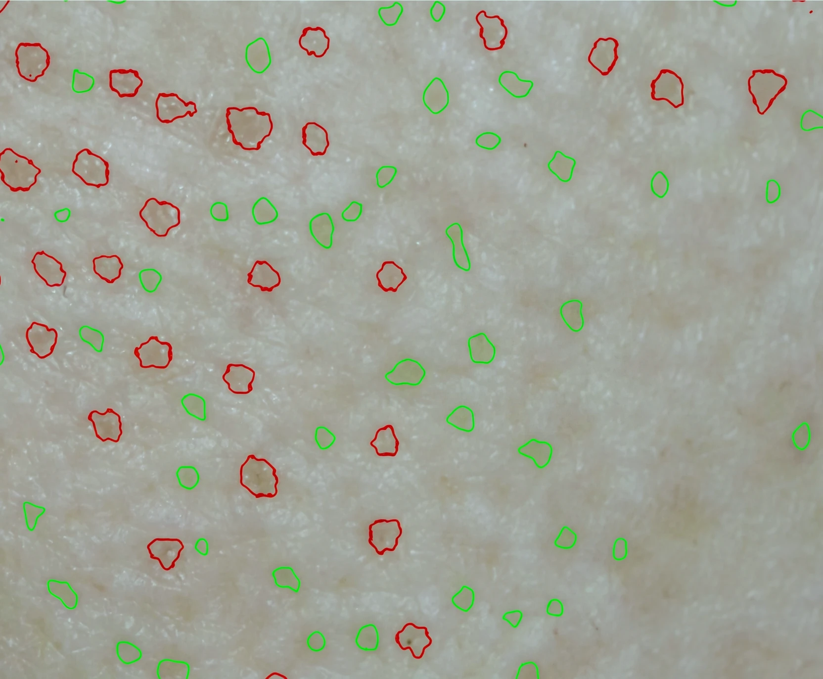 시술 후