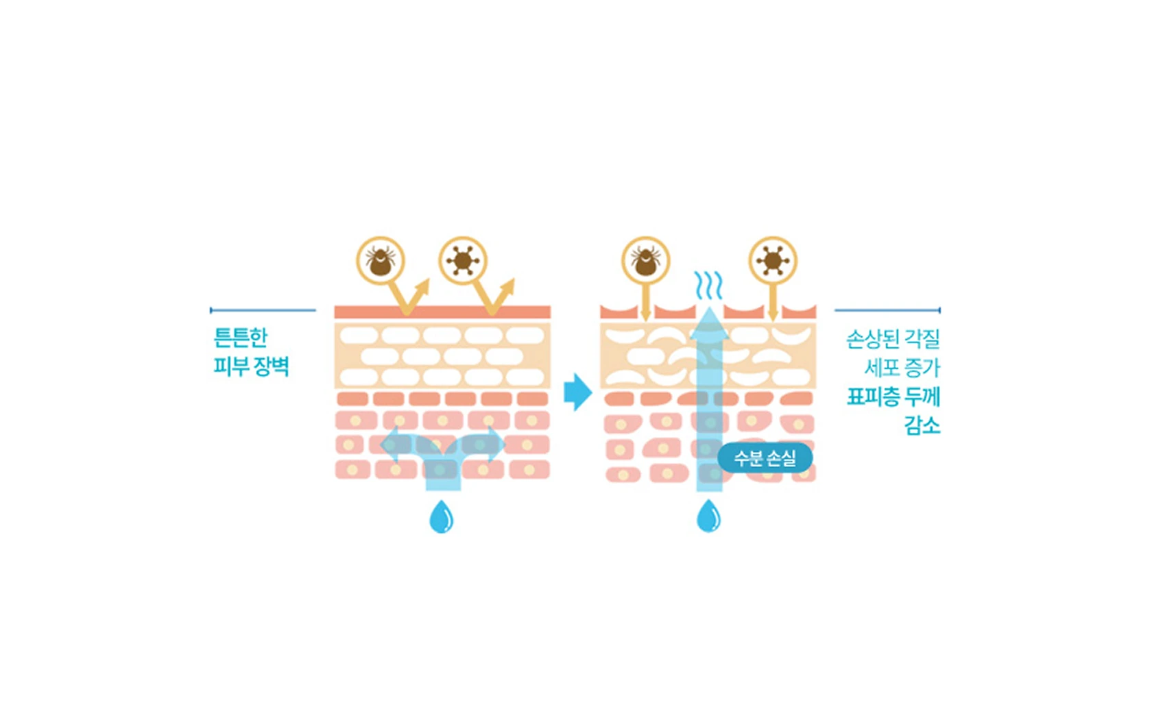 아쿠아포린3 감소에 따른 피부 변화